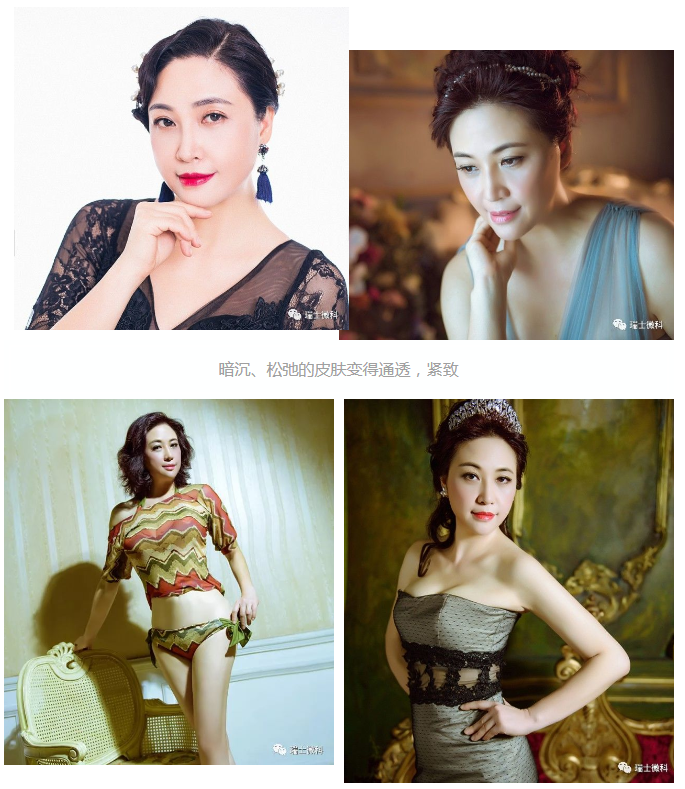 瑞士微科张女士案例分享