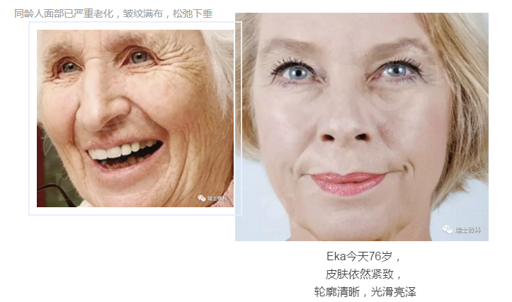 瑞士微科皮肤机能再造Dr.Horst博士的太太Eka女士