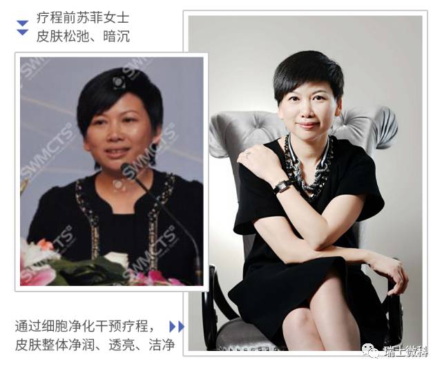 瑞士微科案例