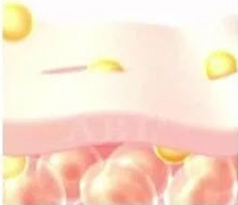 细胞启动疗程全面修复内机能,加速毒素的排出,同时刺激真皮层成纤维母细胞的活性,持续改善肤质肤色,皮肤紧实年轻。