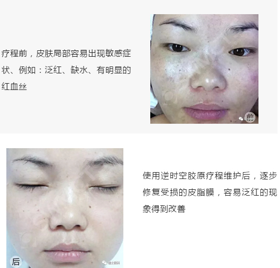 毛凯丽使用微科对比