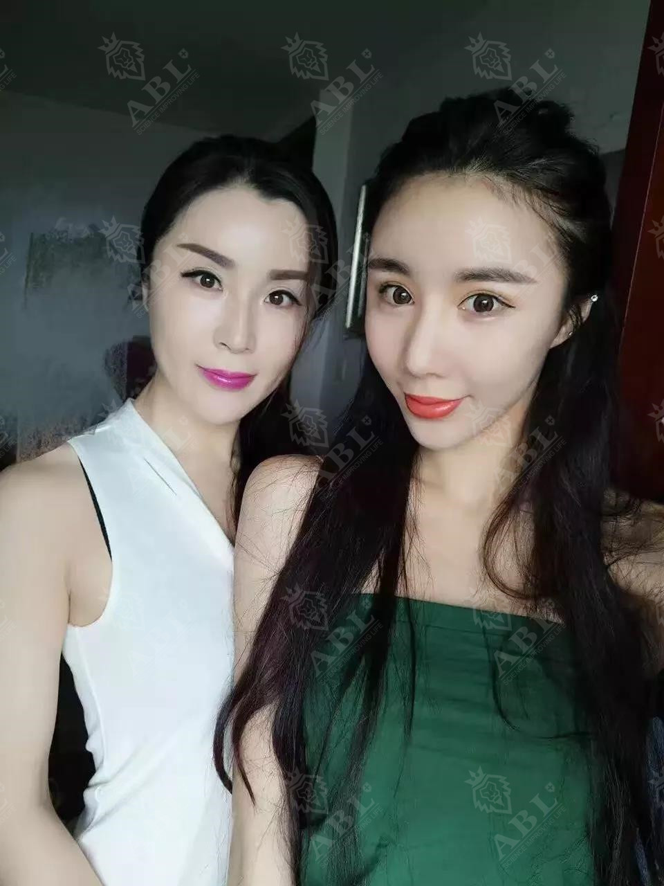 微科金女士案例分享