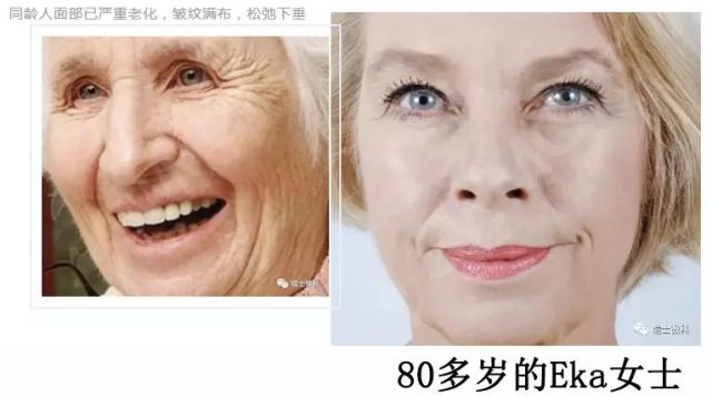 坚持使用微科皮肤健康管理系统维护皮肤机能年轻态的Eka女士,80多岁了,皮肤依然紧实,饱满,看起来比同龄人年轻15-20岁!