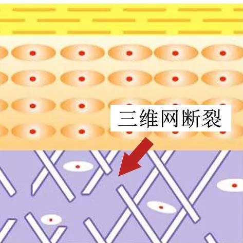 皮肤三维网断裂