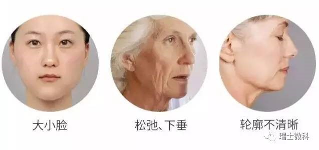 瑞士微科抗衰老